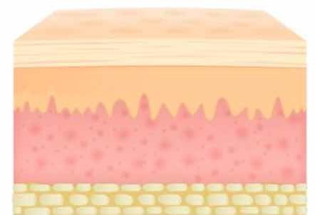 skin3 skin3